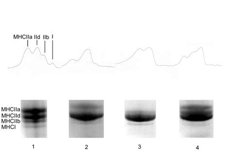 Electrophoretic Separation Of Myosin Heavy Chain Isoforms Myosin