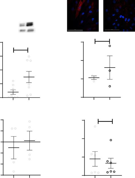 Expression Of Asma And Collagen In Pss And Control Msg Mscs A