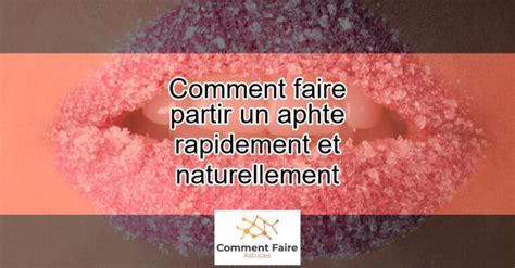 Comment Faire Partir Un Aphte Rapidement Et Naturellement Actualizado