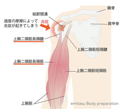 上腕二頭筋長頭腱炎 エミタス整体院