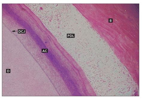 Cementum Histology