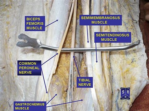 Sciatic Nerve Wikipedia