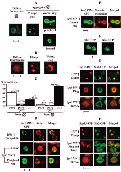 Colocalization Of Sup Aggregates With Cytoskeletal Components Related