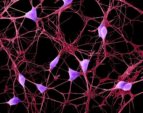 Cortical Neurons Photograph By Dennis Kunkel Microscopyscience Photo