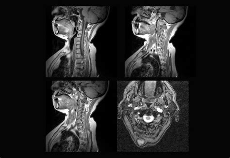 Premium Photo Cervical Spine Mri And Ct Scan Xray Images Professional