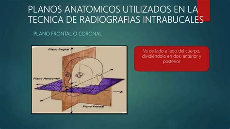 Tecnicas Radiograficas Intrabucales Ppt