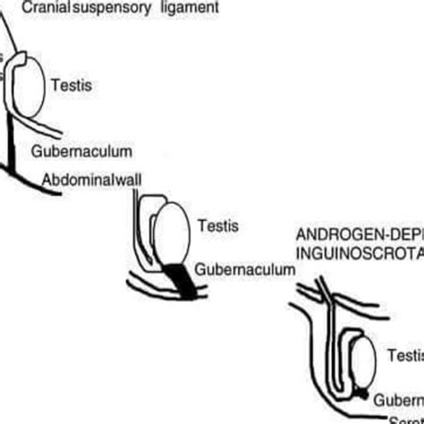 Pdf “gubernaculum Anomalies” Embryological Basis And Its Clinical