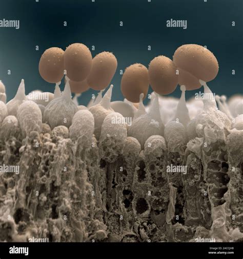 Las Esporas De Hongos Color Análisis Micrografía De Electrones Sem