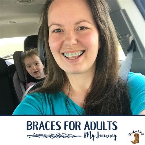 Braces for Adults - My Journey - Dirt Road Style Blog