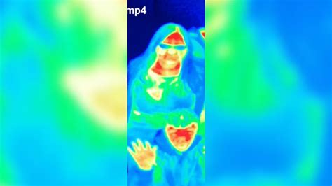 Heat Camera At Edinburgh Attraction Spots Tourists Breast Cancer Cnn