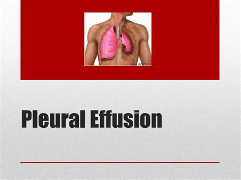 Solution Pleural Effusion Studypool