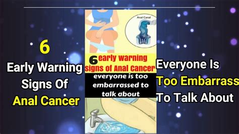 6 Early Warning Signs Of Anal Cancer Everyone Is Too Embarrassed To