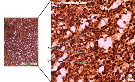 Reticular Tissue – Human Body Help