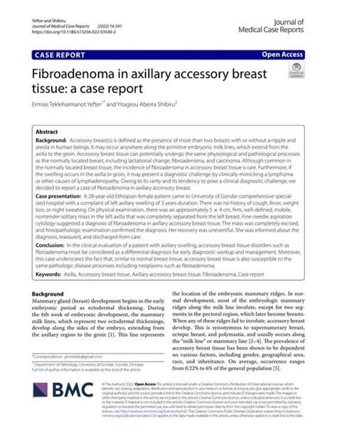 Fibroadenoma De Mama Andrea Udocz