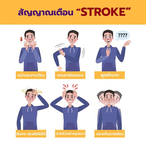 stroke คอ อะไร รจกกบเสนเลอดในสมองแตก โรคยอดฮตใกลตวทไมควร