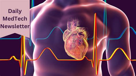 Advancements in Aortic Repair: Unveiling the Branched Aortic Stent ...