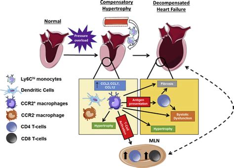 Ccr2 Monocyte Derived Infiltrating Macrophages Are Required For Adverse Cardiac Remodeling