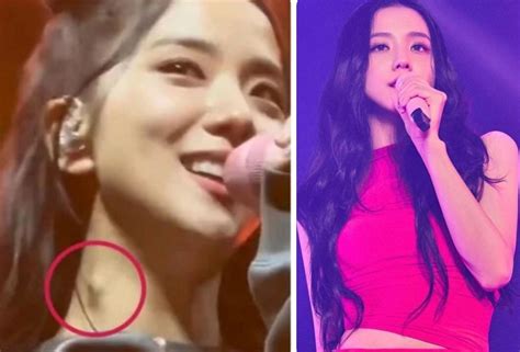 Blackpinks Jisoo Worries Fans After Shes Spotted With A Lump On Her Neck The Star