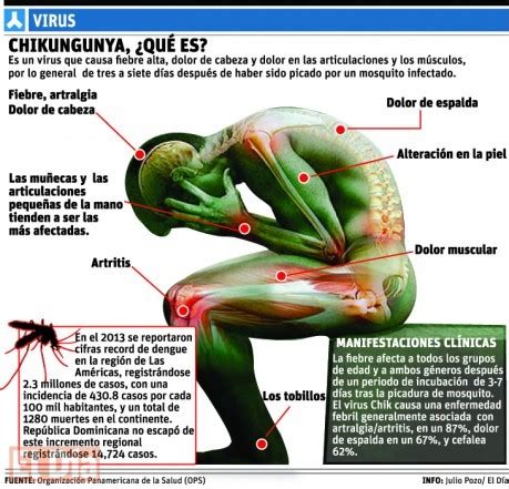 Medicina En El Lenguaje De La Gente Chikungunya Todo Lo Que Se Tiene