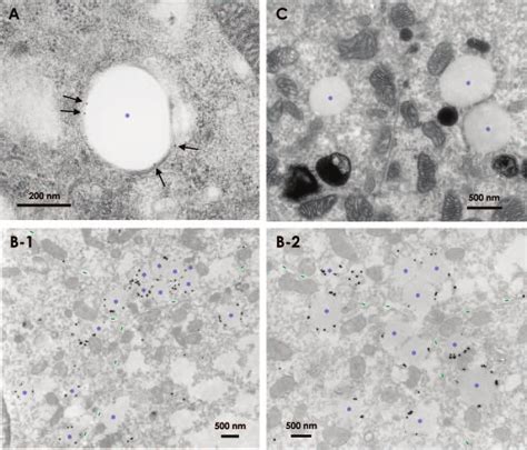 Immunogold Electron Microscopy Of Adrp In Mouse Rpe A Postembedding