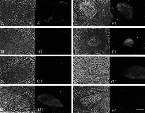 Phase Contrast And Fluorescence Micrographs Of Frozen Sections Through