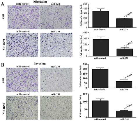 miR 338 inhibits the metastasis of lung cancer by targeting integrin β3