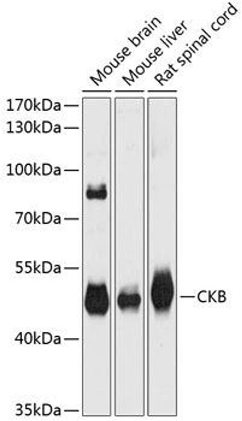 Anti Ckb 抗体 Cab12632 Assay Genie