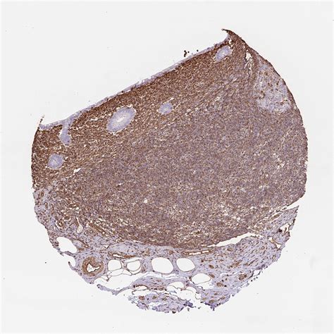 Tissue Expression Of Vim Staining In Appendix The Human Protein Atlas