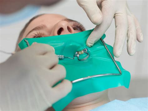 When To Use A Dental Dam At Tracy Sudie Blog