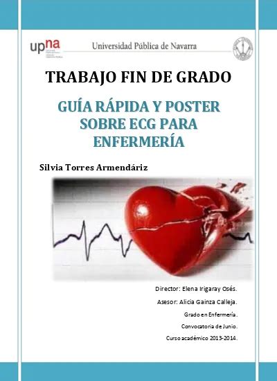 Las principales arritmias y su interpretación electrocardiográfica