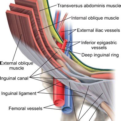 Diagram of right inguinal canal anatomy depicts the main elements that ...