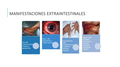 Colon Recto Y Ano PPT