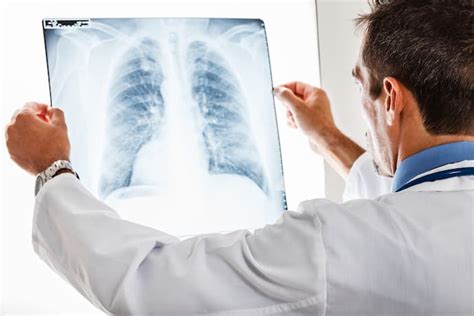 Pulmones Sanos Gu A De Cuidado Pulmonar Bupa Latinoam Rica