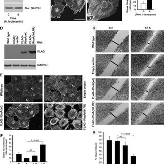 Rho Kinase Inhibition Suppresses Synaptopodin Or Lactacystin Induced