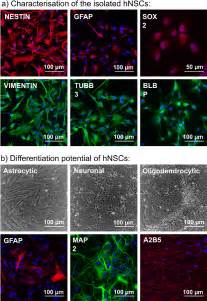 Characterization Of Isolated HNSCs A Expression Of Neural Stem