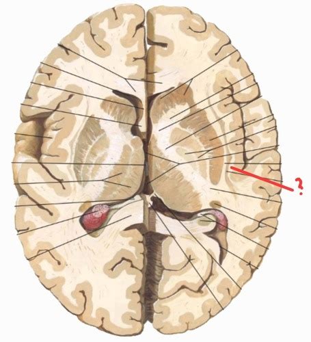 Telencephalon - obrázky Flashcards | Quizlet