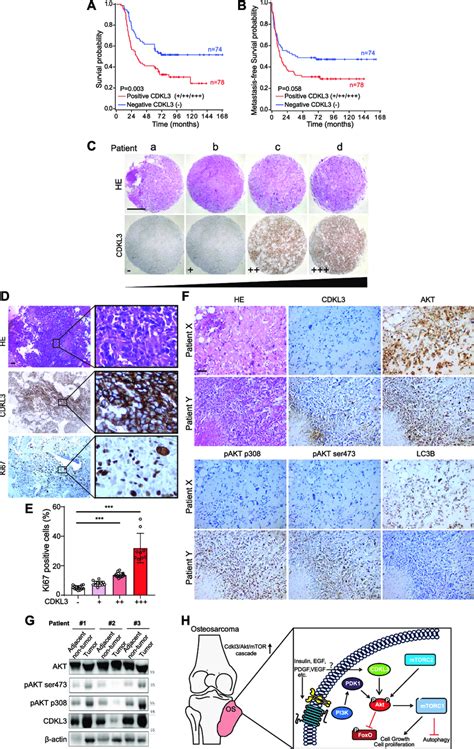 Cyclin Dependent Kinase Like 3 Cdkl3 Defines Poor Prognosis And