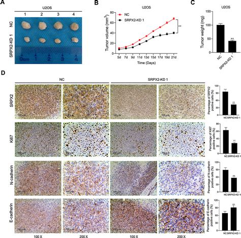 Srpx2 Promotes Cell Proliferation And Invasion In Osteosarcoma Through Ott