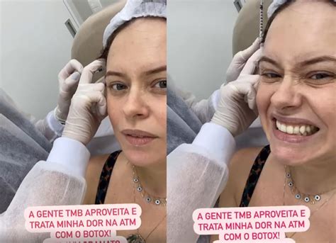 Mariana Bridi Aplica Botox No Rosto Para Auxiliar Tratamento