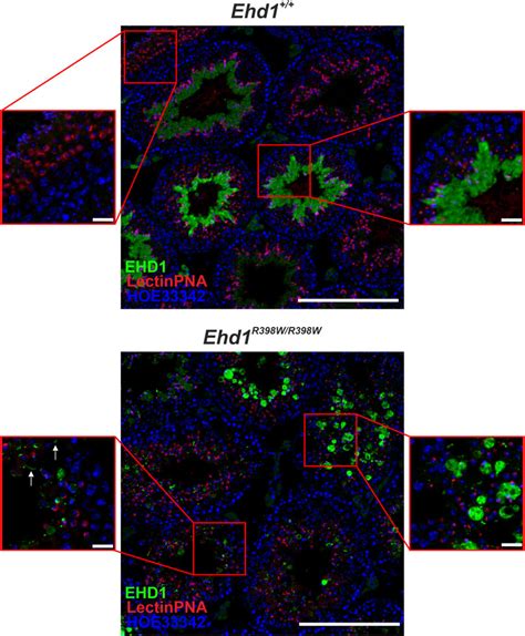 Frontiers A Missense Mutation In Ehd1 Associated With Defective