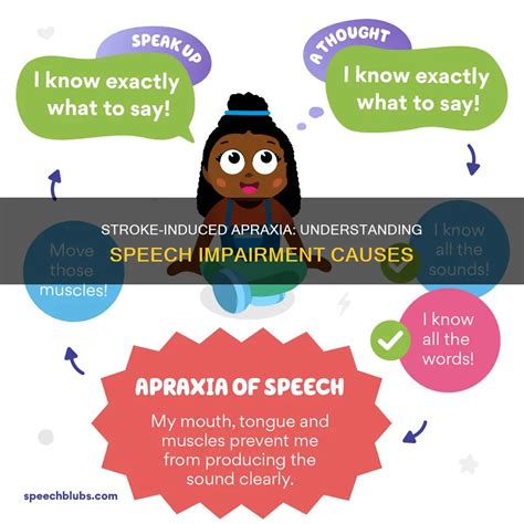 Stroke Induced Apraxia Understanding Speech Impairment Causes MedShun