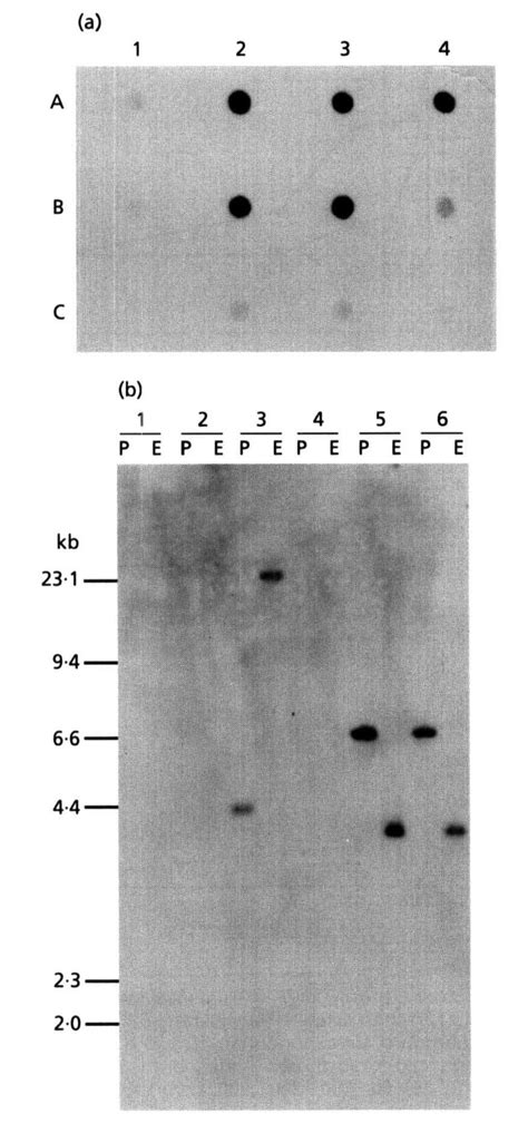 A Dot Blot Hybridization Of Total Cellular Rna To A 32plabelled P