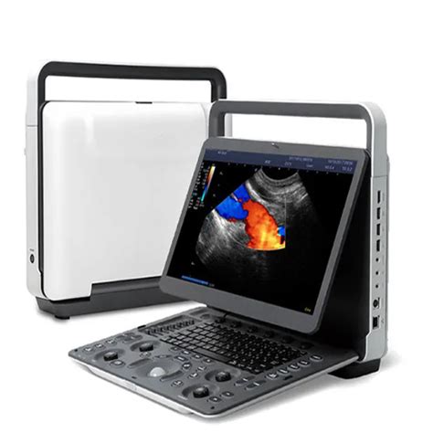 China 2023 Sonoscape E2 E2 Pro Portable Color Doppler System 3D 4D 5D