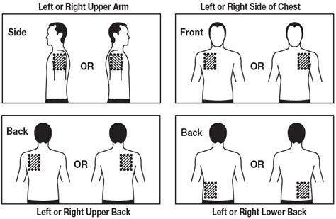 Rivastigmine Patch: Package Insert / Prescribing Information