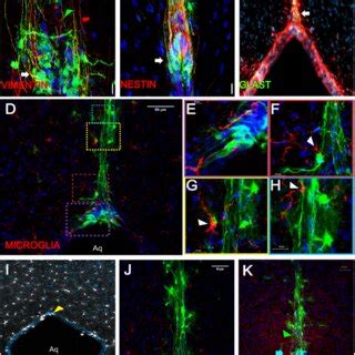 Molecular Identity Of The Cells In The Aqueduct Most Of The Cells That