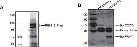 Figures And Data In Cross Talk Between Prmt1 Mediated Methylation And