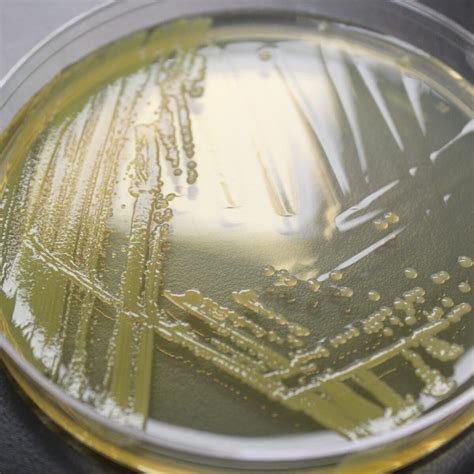 Burkholderia Cepacia Microchem Laboratory