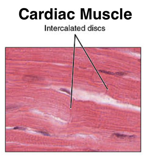 Characteristics of cardiac muscles are that they(a) Contract quickly ...