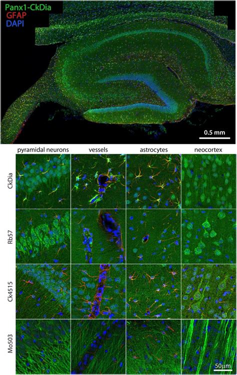 Large Scale Mosaic Imaging Of Hippocampus And Neocortex Lying Adjacent