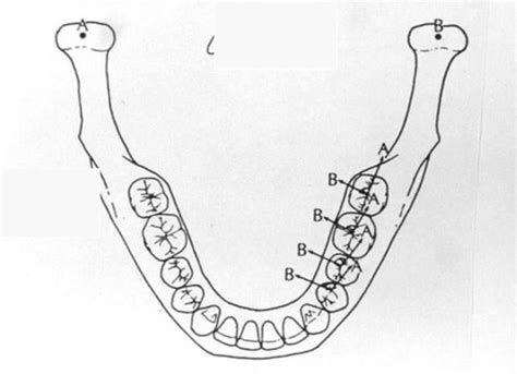 LECTURE 13 DETERMINANTS OF OCCLUSAL MORPH PART II HORIZONTAL